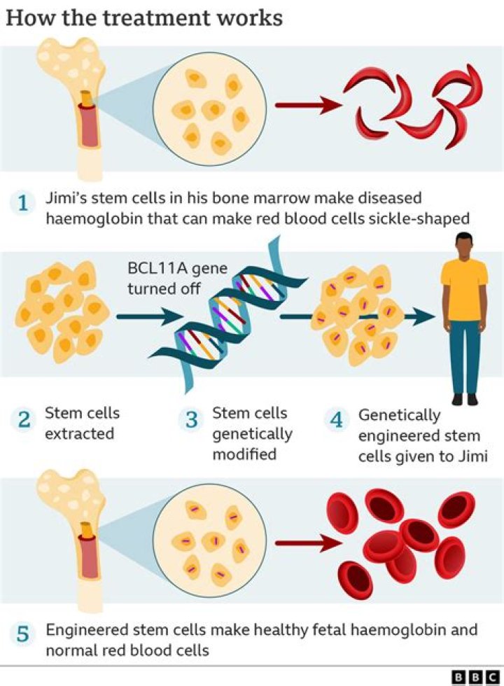 How can stem cells be used to treat diseases GCSE