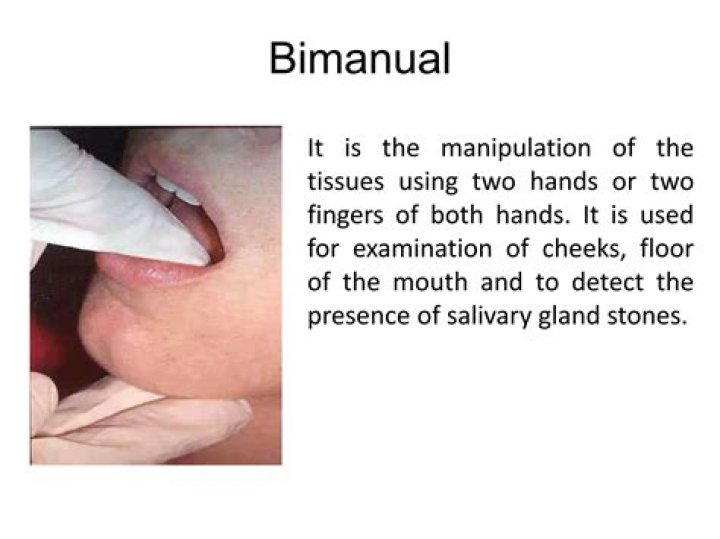 Is a bimanual exam necessary