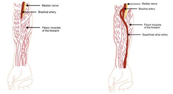 What muscles does the ulnar artery supply
