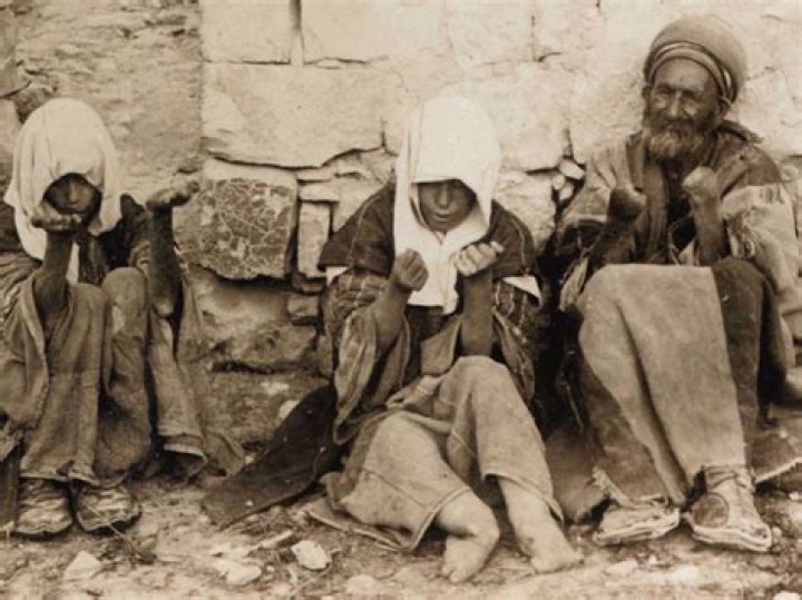 Where are leprosy colonies