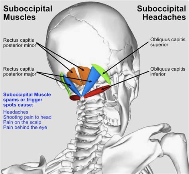 Which Suboccipital muscle is responsible for hyperextending the head